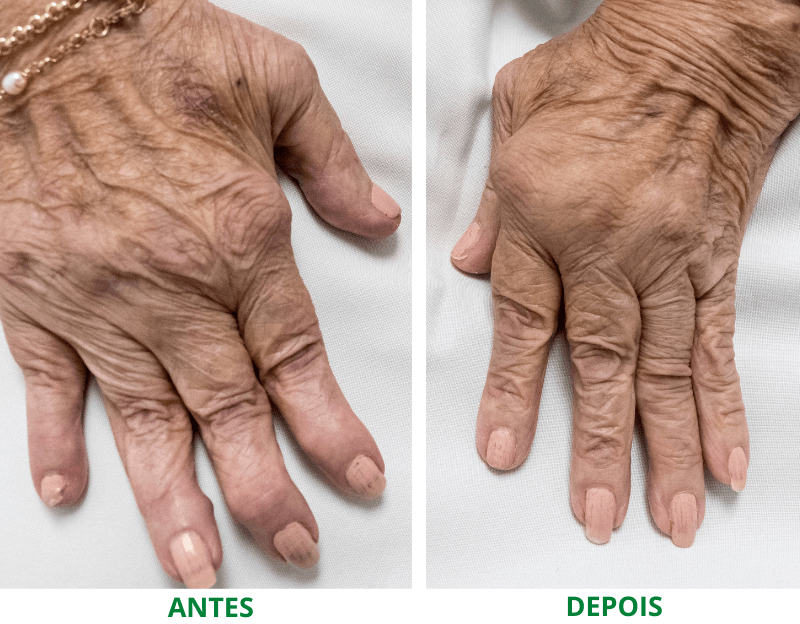 Tomar vários remédios para dor sem resultados satisfatórios?